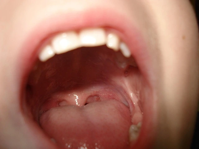 teeth for tearing food - What Are Teeth for Tearing Food? teeth for tearing food - What Are Teeth for Tearing Food?